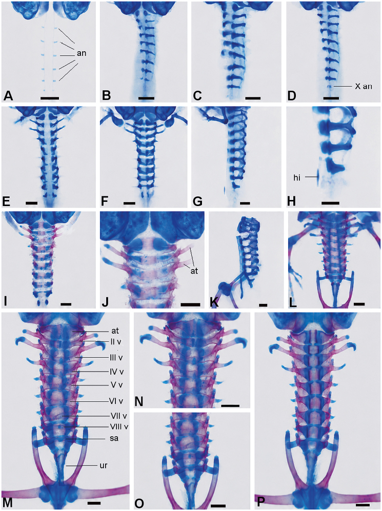 Serie de imágenes microscópicas en azul y rosa que muestran diferentes vistas y detalles de la columna vertebral y pelvis de un espécimen, con etiquetas anatómicas en algunas secciones.

Descripción generada con IA